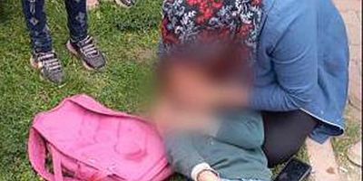 Kayseri’de Otomobilin Çarptığı Çocuk Yaralandı